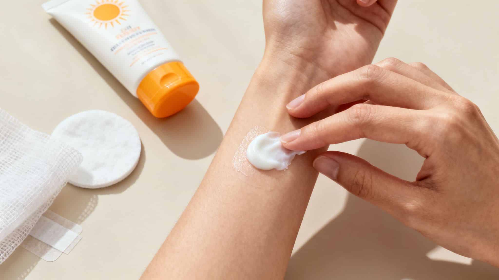Une personne applique une crème blanche sur son avant-bras. Un tube de crème solaire, des cotons et une gaze sont visibles en arrière-plan.
