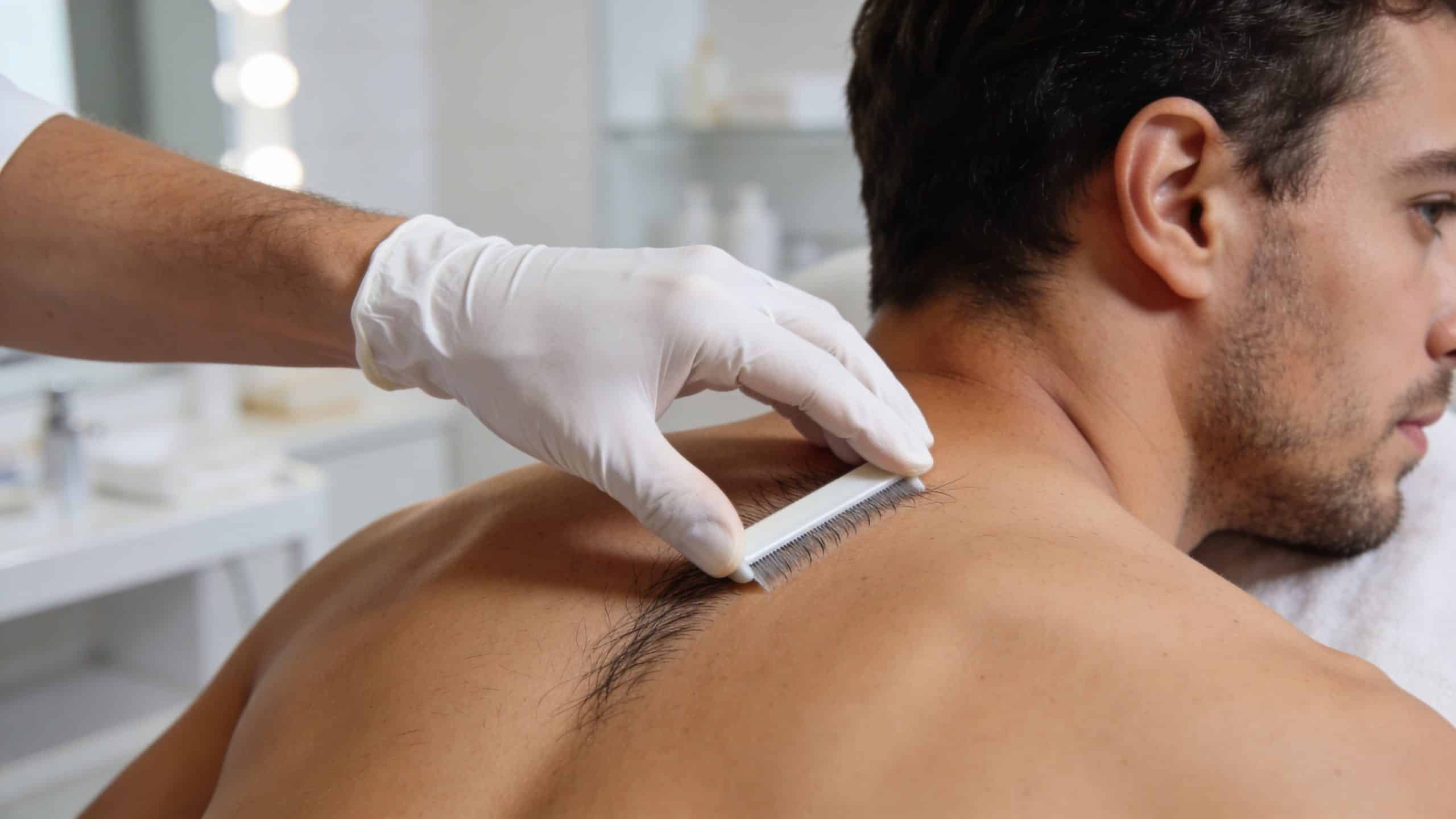 Un professionnel portant des gants blancs effectue une séance d'épilation du dos sur un homme dans un institut.