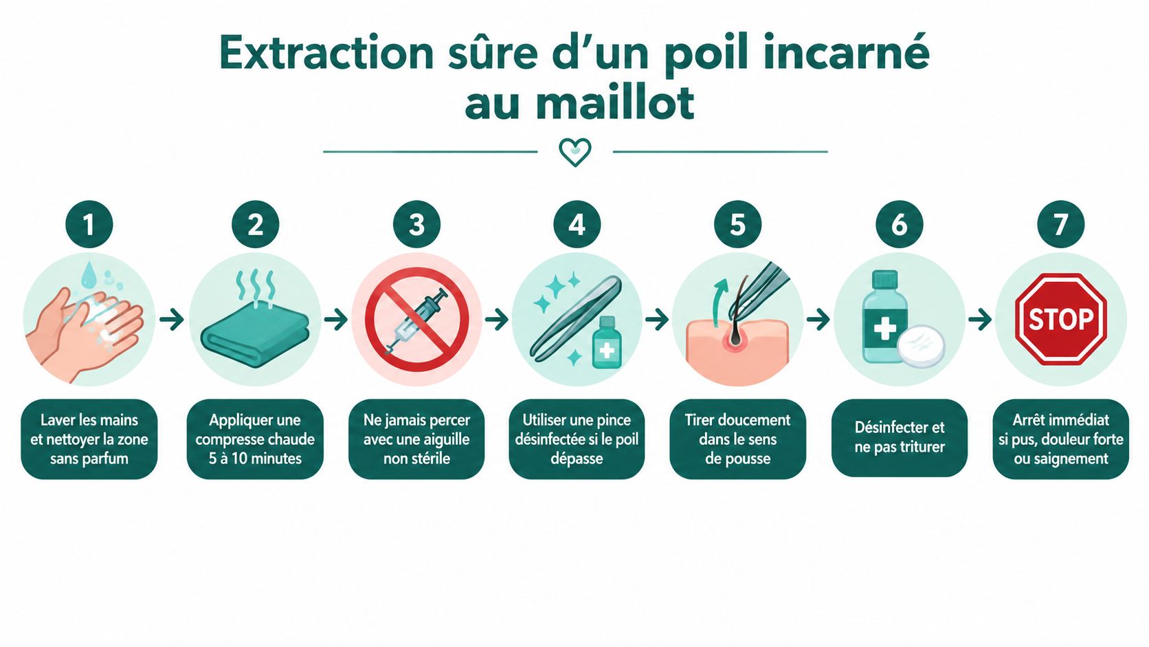 Infographie étape par étape montrant la méthode sûre pour extraire un poil incarné au maillot.